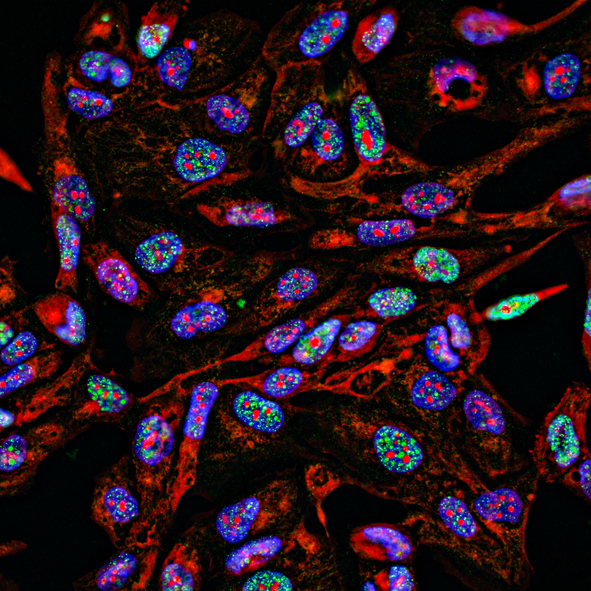 cancer cells on image 