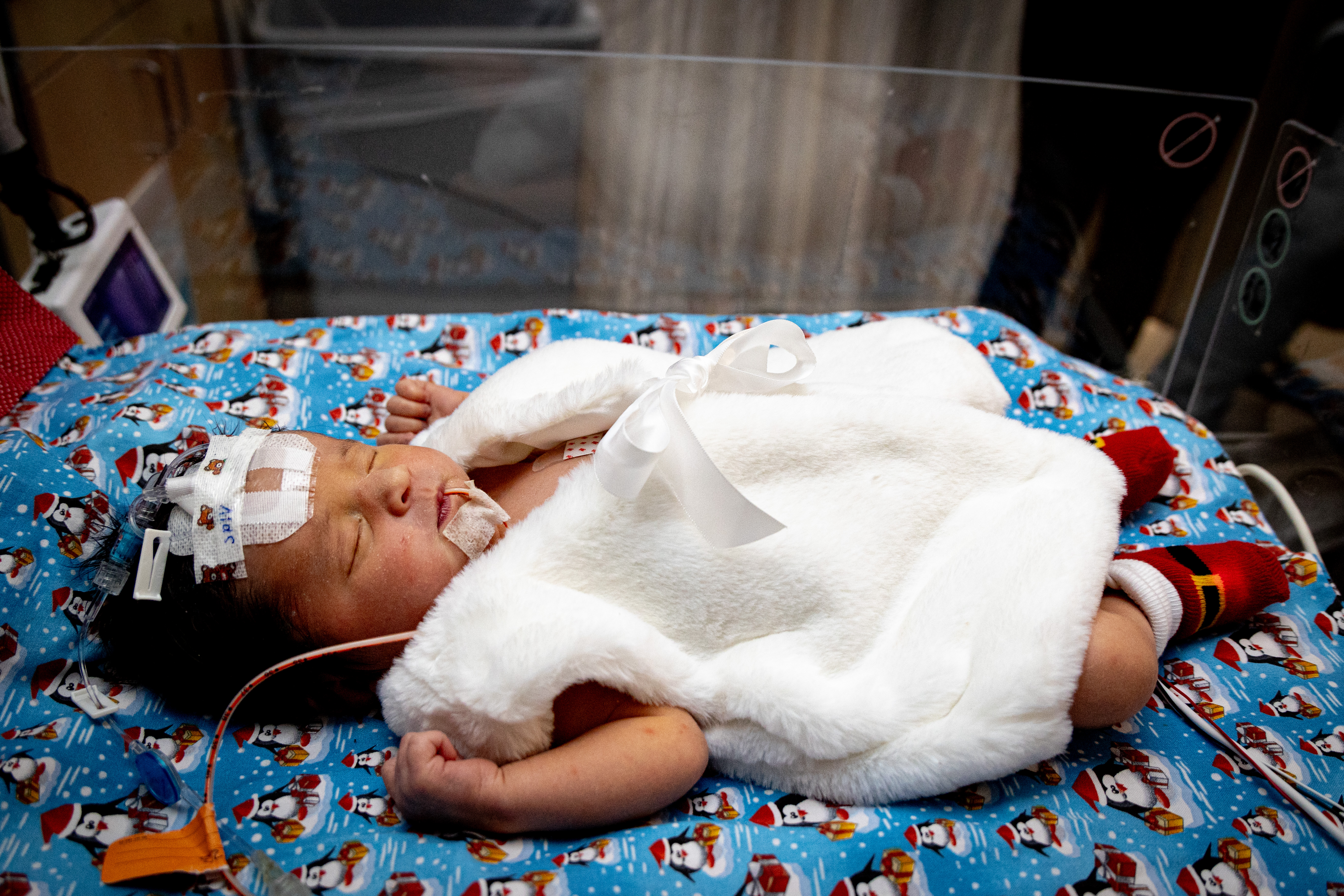 A NICU patient wears a festive holiday outfit. 