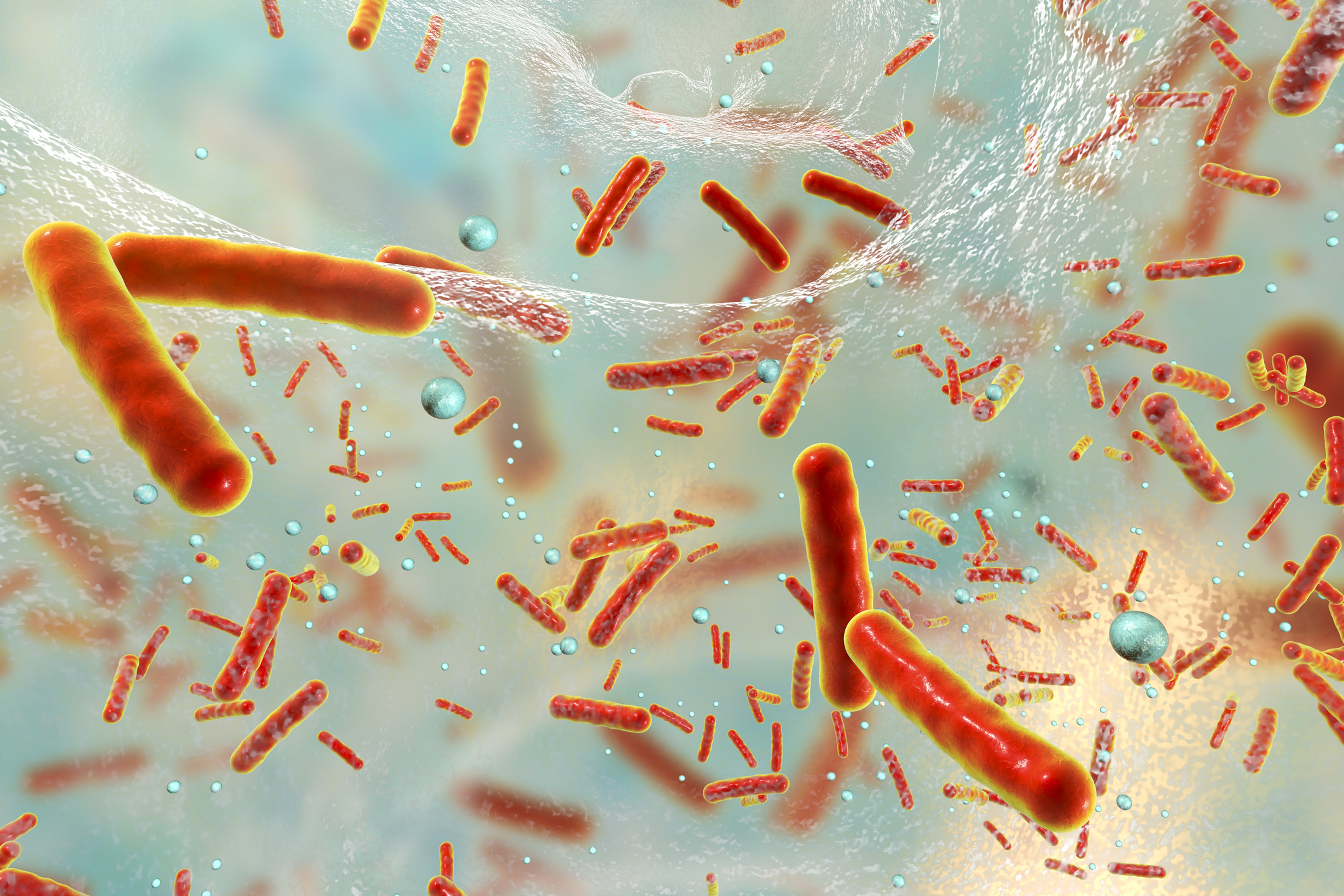 sepsis