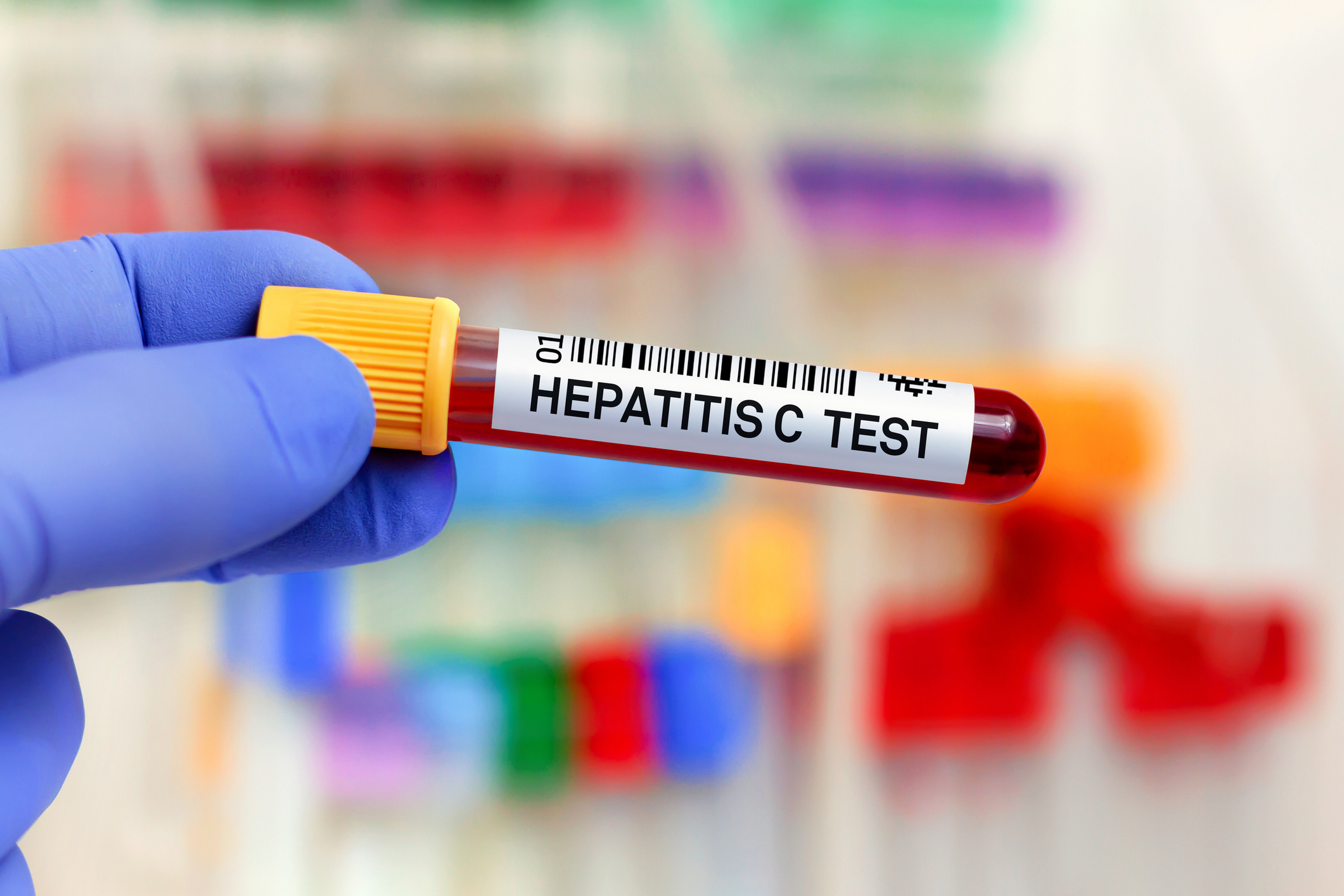 Hep C banner