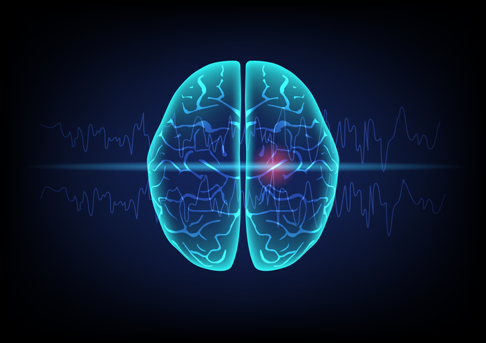 Brain image