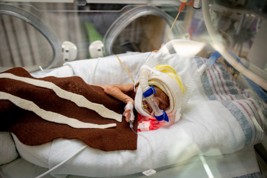 NICU patient dressed up as bacon for Halloween