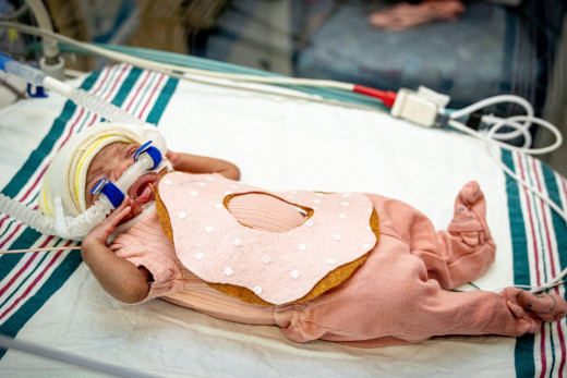 NICU patient dressed up as a donut for Halloween