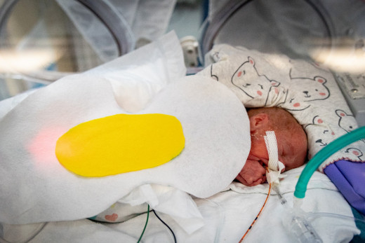 NICU patient dressed up an egg Avenger for Halloween