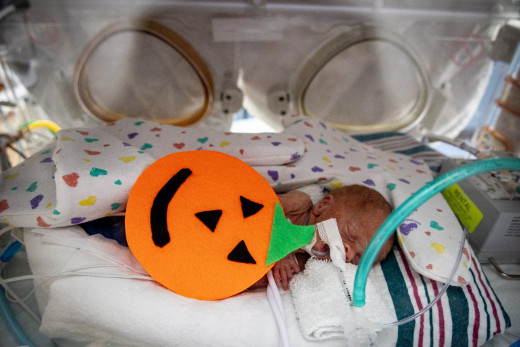 NICU patient dressed up as a pumpkin for Halloween
