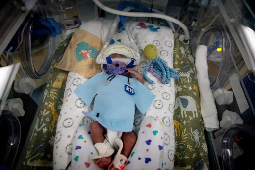 NICU patient dressed up for Halloween