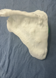 posterior view of 3D printed scapula
