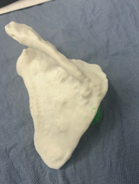 isometric posterior view of 3D printed scapula