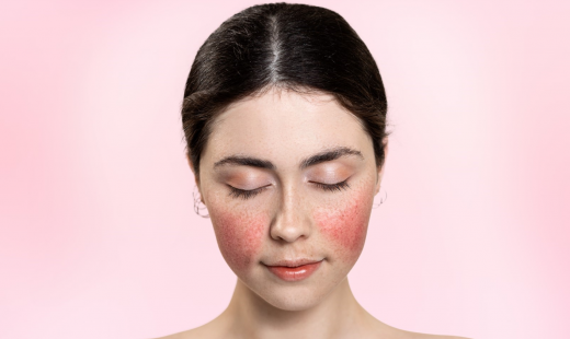 woman's face with red cheeks