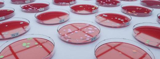 bacteria in petri dishes