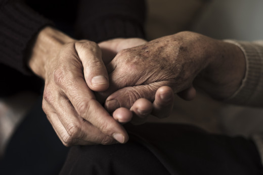 aging hands
