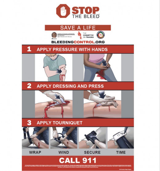 Stop the Bleed Quick Guide