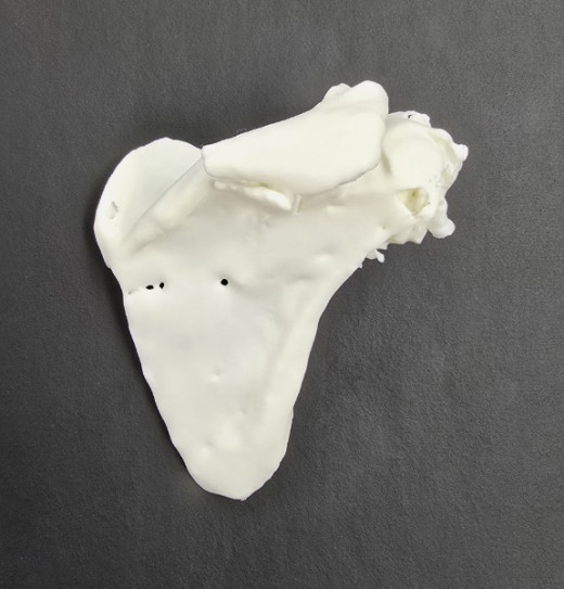 3D printed scapula