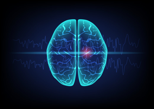Brain waves